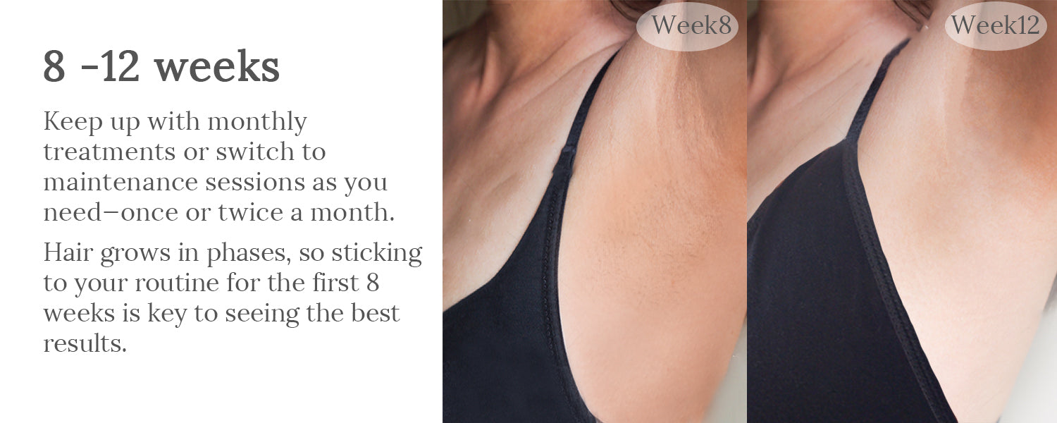 RaysDanc IPL laser hair removal results at home, Best IPL Laser Hair Removal results at home, Permanent Hair Removal, Facial Hair Remover; remove body face underarms hair permanently