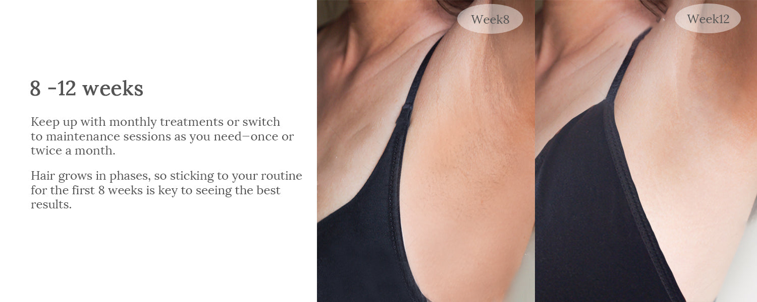 raysdanc ipl laser hair removal results before and after