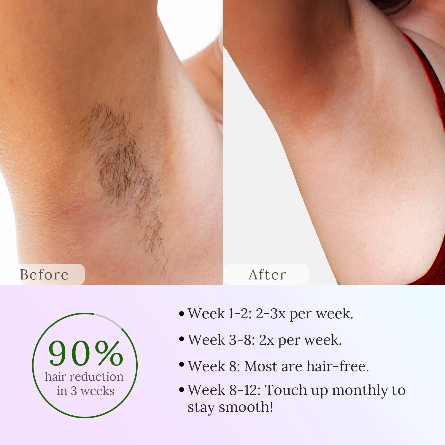 RaysDanc IPL laser hair
removal results at home IPL laser hair removal before and after
